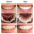 Creme Dental Clareador – Higiene e Sorriso Brilhante