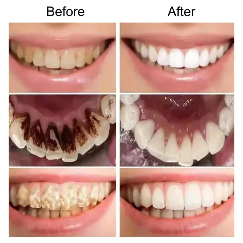 Creme Dental Clareador – Higiene e Sorriso Brilhante