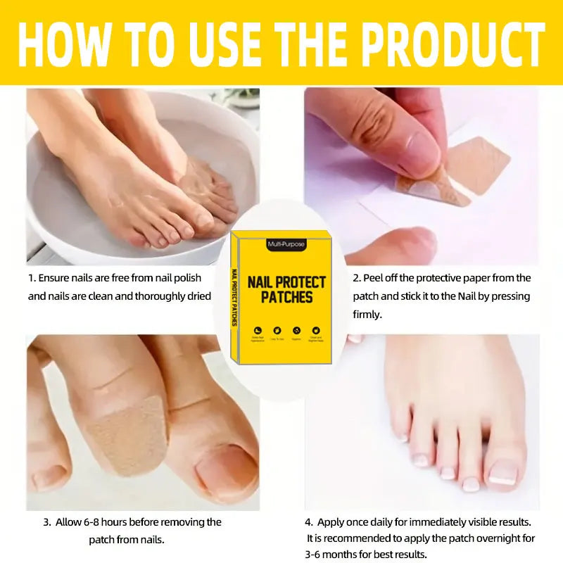 88 Adesivos para Unhas – Renovação e Proteção de Unhas Encravadas