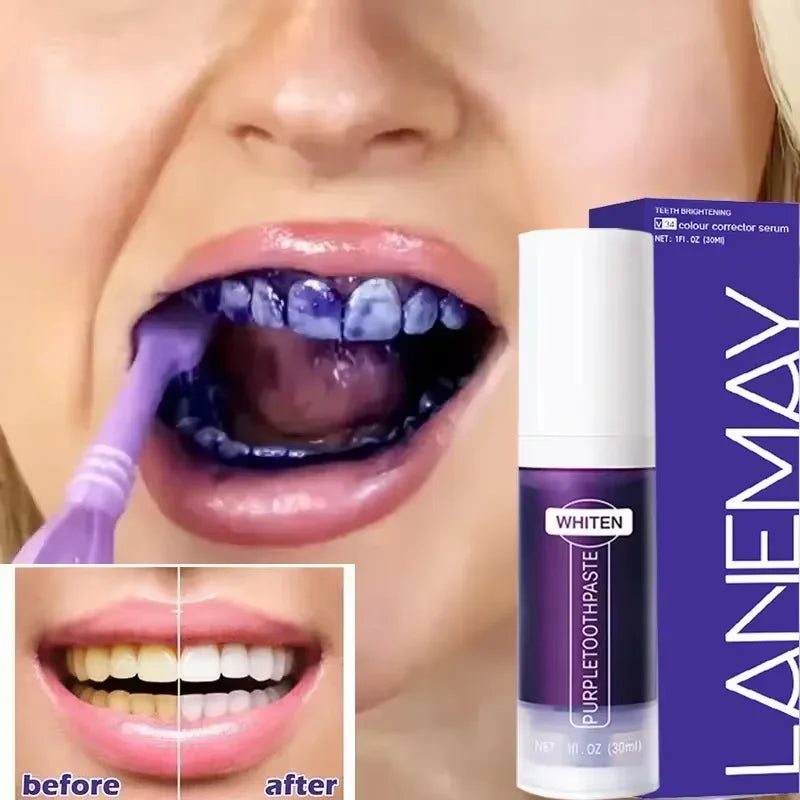 Creme Dental Clareador – Higiene e Sorriso Brilhante
