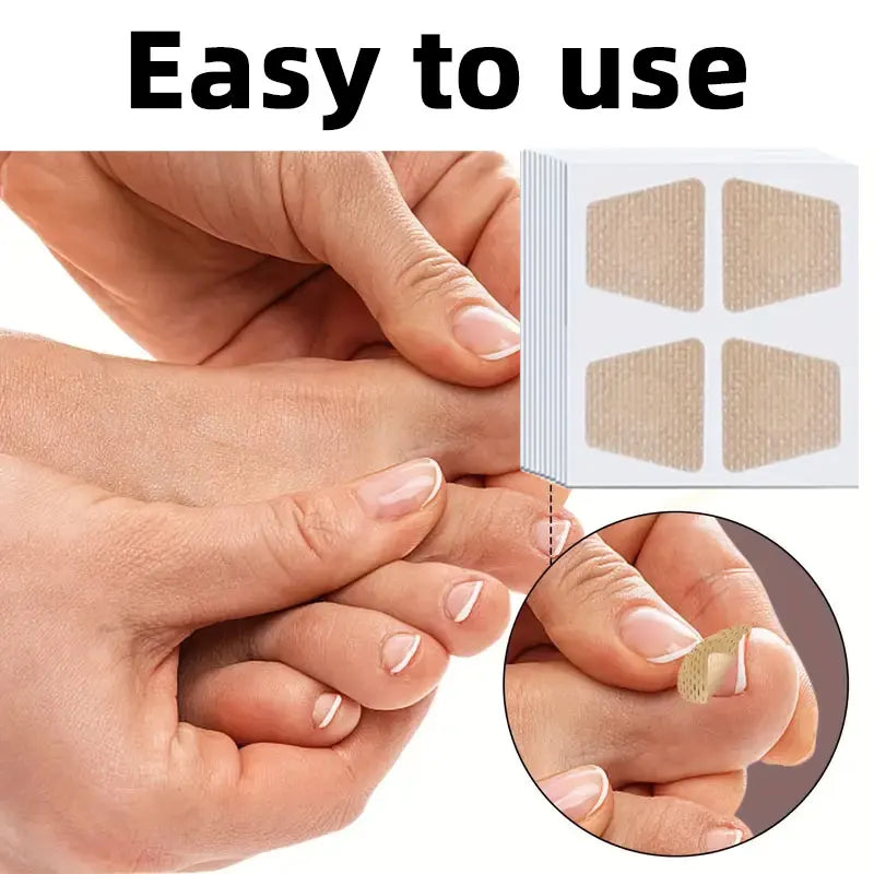 88 Adesivos para Unhas – Renovação e Proteção de Unhas Encravadas