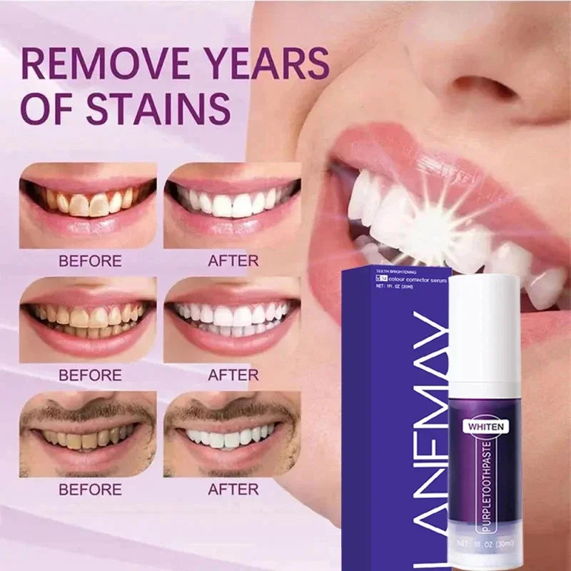 Creme Dental Clareador – Higiene e Sorriso Brilhante